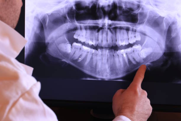 Best Dental Abscess Treatment in , TX